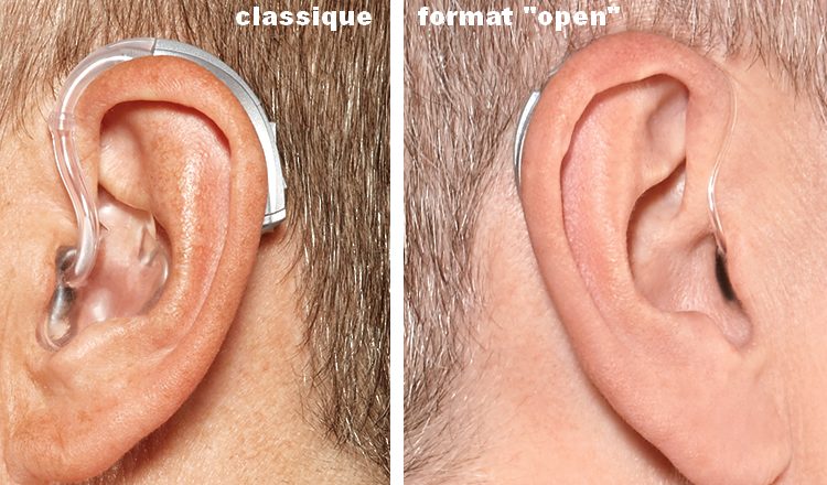 Contours oreille